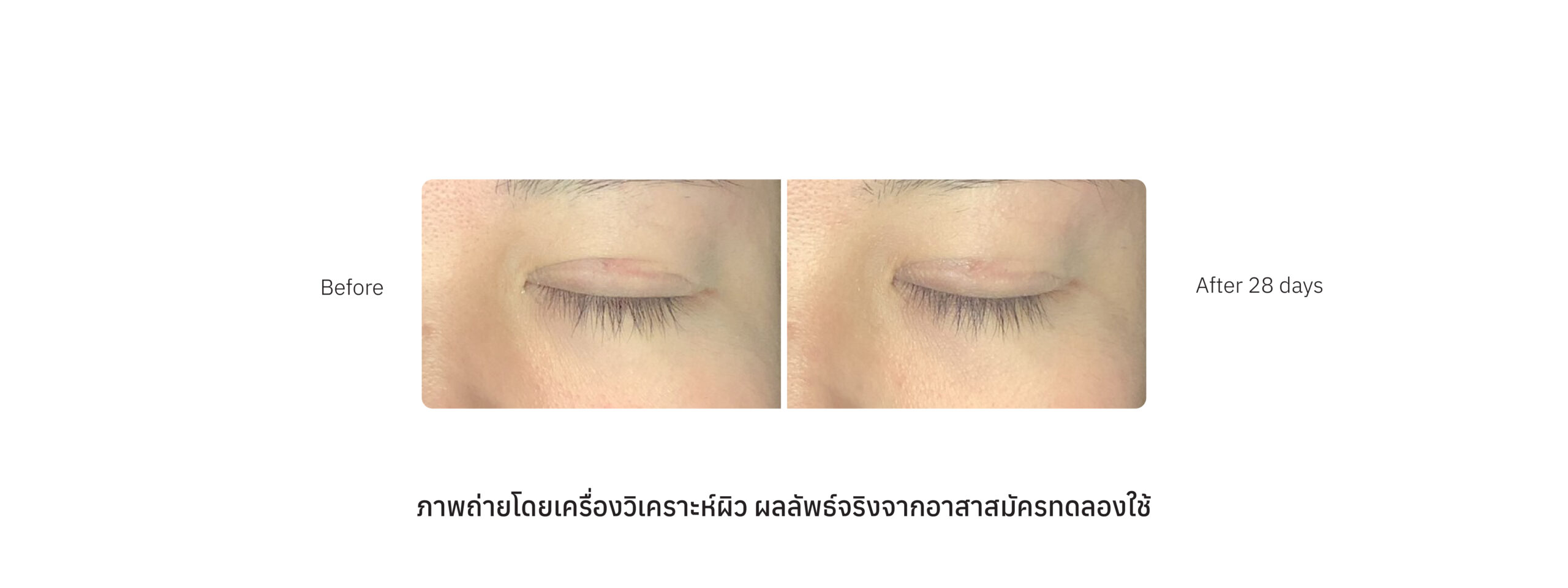 Eyes Compare_Case 04