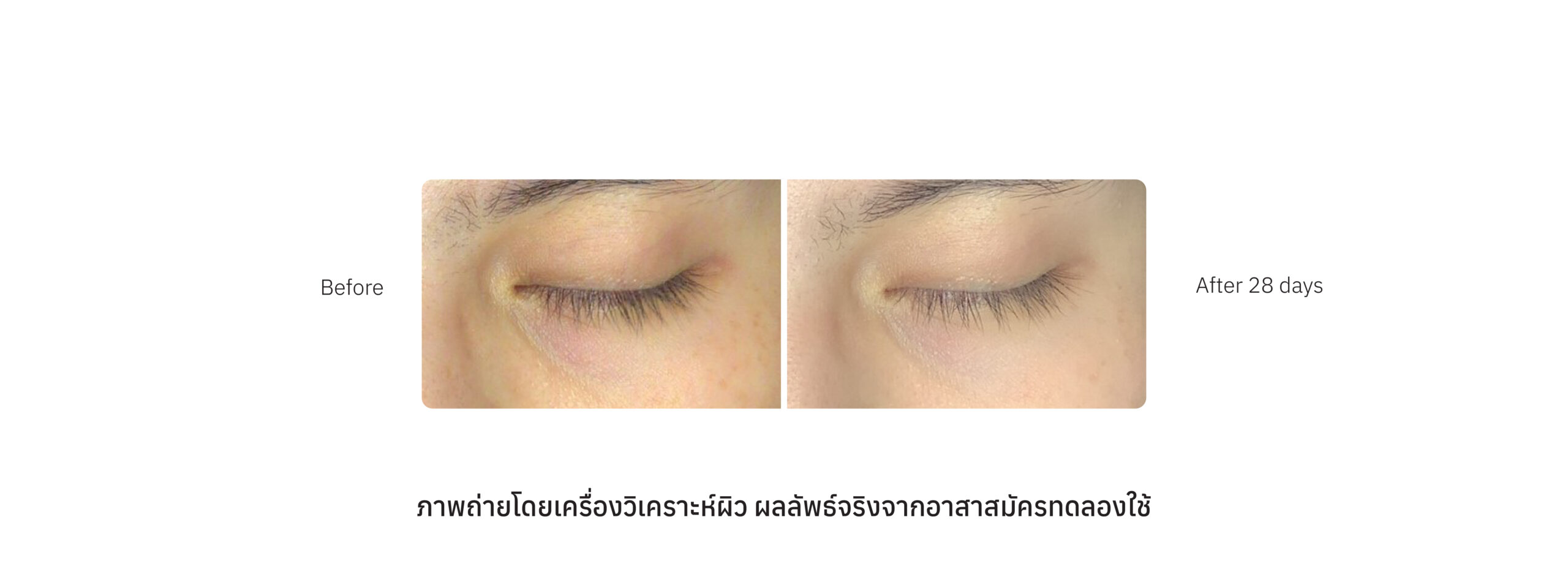 Eyes Compare_Case 14